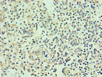 SMYD1 Antibody