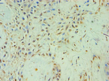 TBL1XR1 Antibody