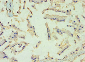 TBL1XR1 Antibody