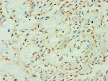 SPIN2B Antibody