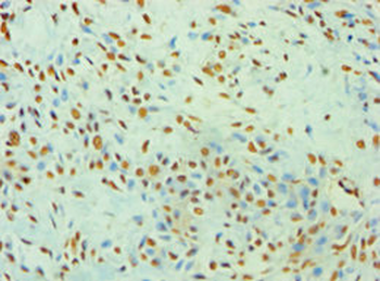 XRCC5 Antibody