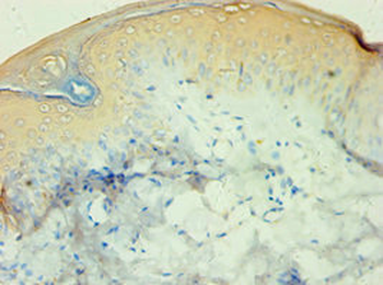CALML5 Antibody