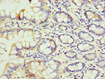 SULT1E1 Antibody