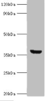 ANXA8L1 Antibody