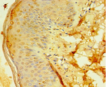 DDX39A Antibody