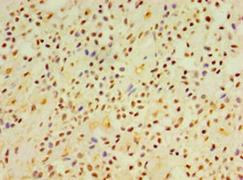 DGKE Antibody