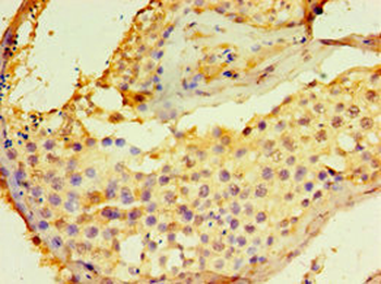 DGKE Antibody