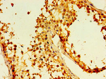 EDA2R Antibody