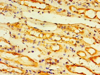 EDA2R Antibody