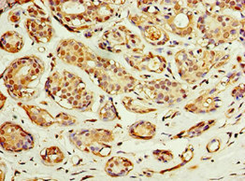 ACSM3 Antibody
