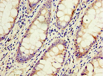 ACSM3 Antibody