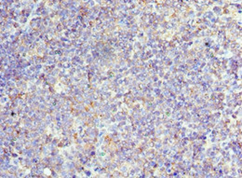 CD6 Antibody