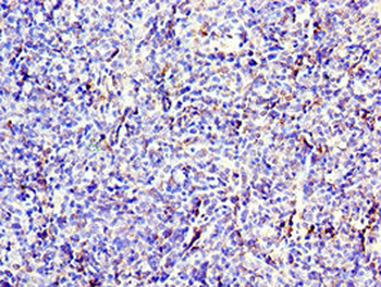CD6 Antibody