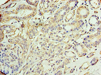 AKAP10 Antibody