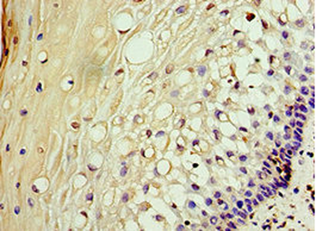 AKAP10 Antibody