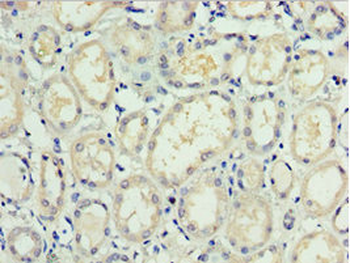 TAF1C Antibody