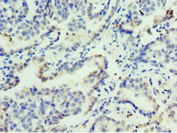 FOSL2 Antibody