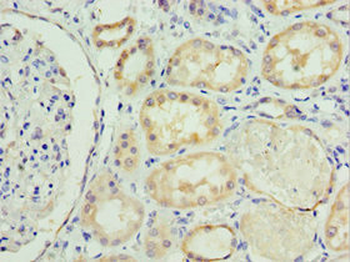 SOST Antibody