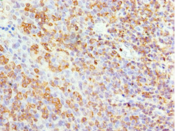 APBB1IP Antibody