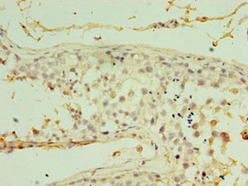 RDM1 Antibody