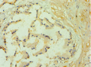 GLO1 Antibody