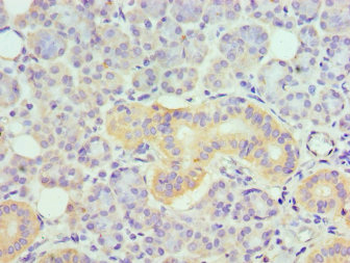 TNFRSF21 Antibody