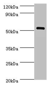MEF2C Antibody
