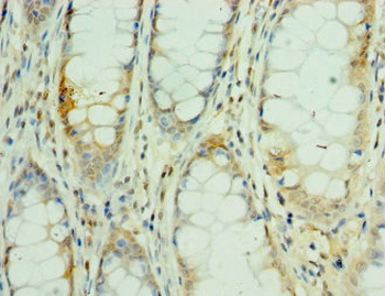 MEF2C Antibody
