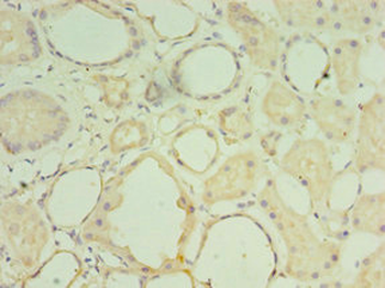 MATN3 Antibody
