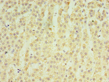 MATN3 Antibody
