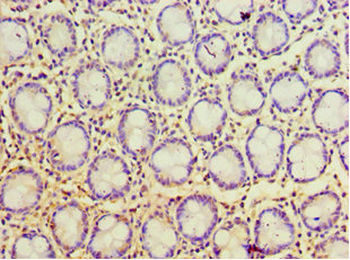 POP7 Antibody