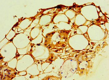 POP7 Antibody