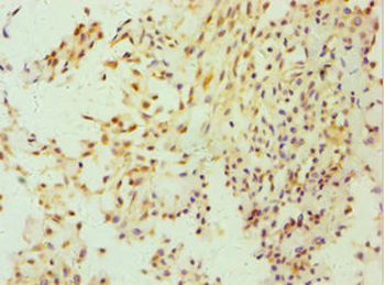 FGFBP1 Antibody