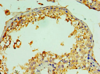 CTSV Antibody