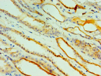 CTSV Antibody