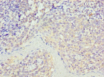 STK16 Antibody