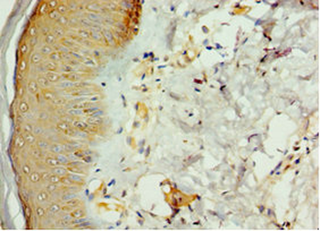 STK16 Antibody