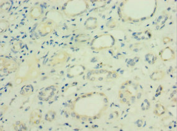 LGALS9 Antibody