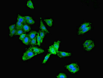 LGALS9 Antibody
