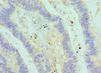 ASMTL Antibody