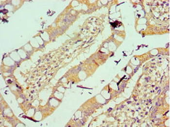 VTN Antibody