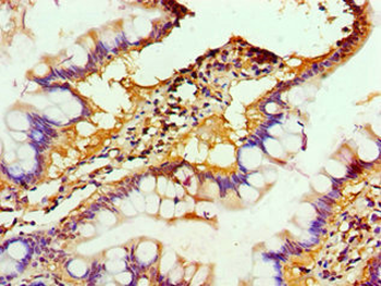 ALKBH2 Antibody