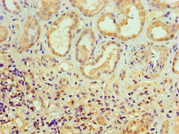 ALKBH2 Antibody