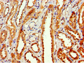 MTMR14 Antibody