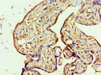 MTMR14 Antibody