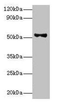 PNPLA3 Antibody
