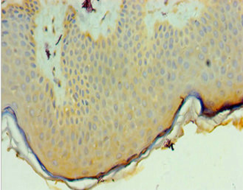 PNPLA3 Antibody