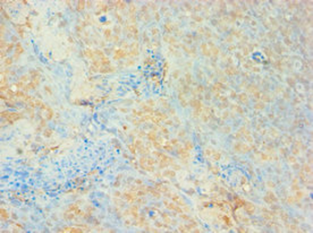 AUH Antibody