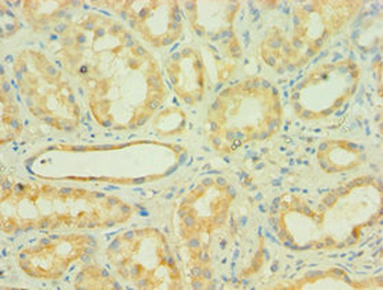 AUH Antibody