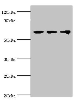 DDX5 Antibody